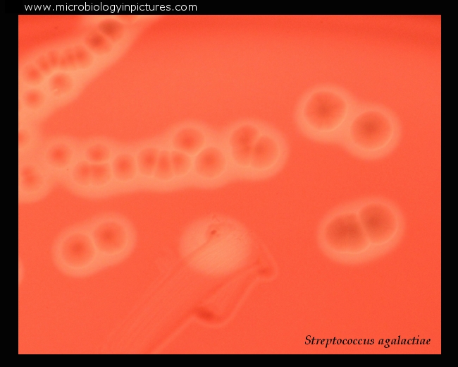 Streptococcus agalactiae colony morphology on blood agar streptococcus agalactiae colony morphology